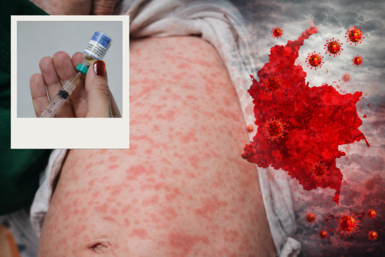 Alerta por sarampión: miles de niños no tienen esquema completo de vacunación